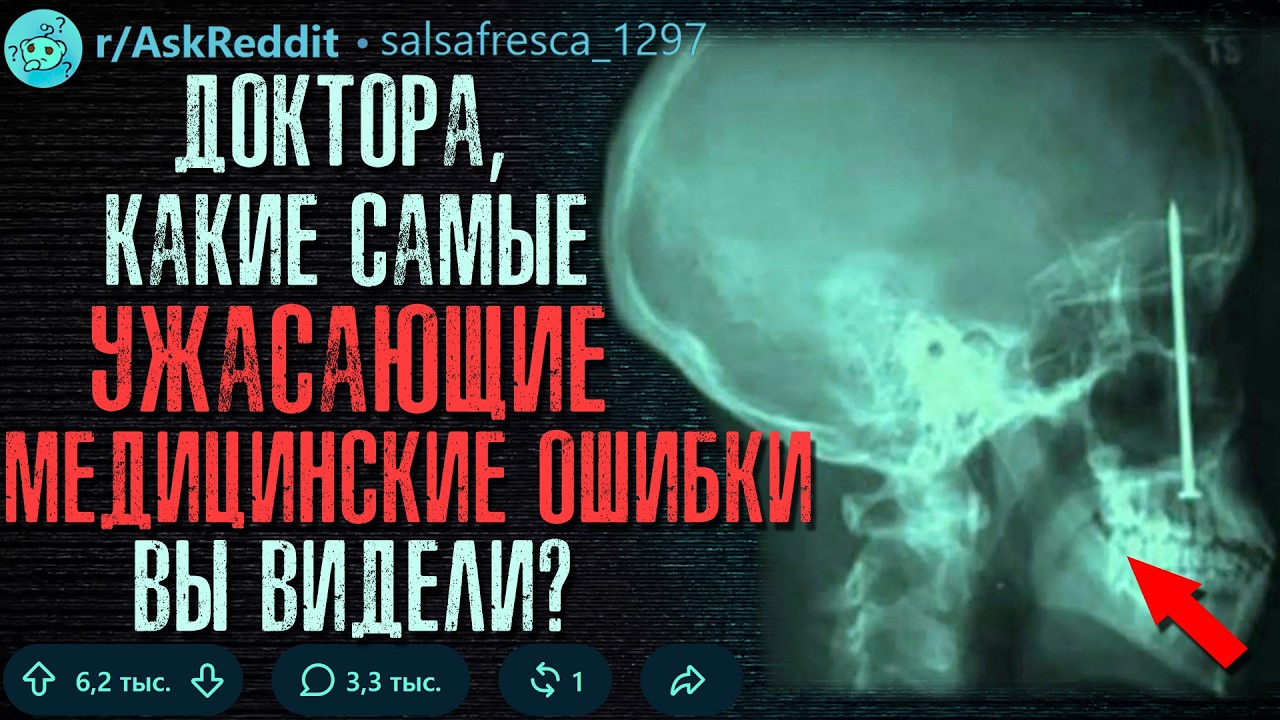 Доктора, Какие Самые УЖАСАЮЩИЕ Медицинские Ошибки Вы Видели?