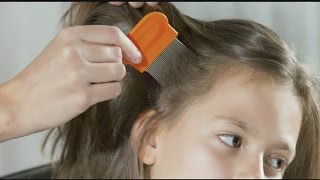 How to prevent, treat head lice