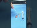 ‍ ️Labioplasty Case With Dr Saldaña ‍ ️ Gynecologist Tijuana Womenshealth Ginecologista