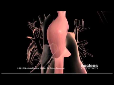 Normal Anatomy Of Aorta - YouTube