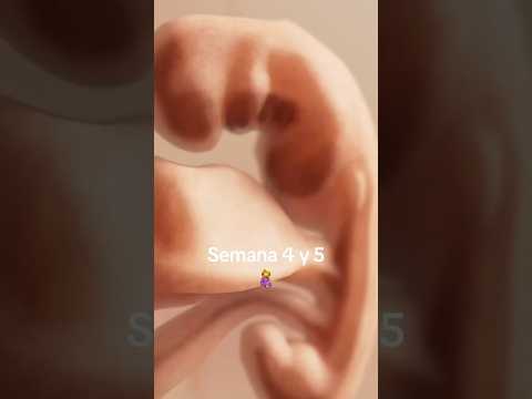 Weeks 4 and 5 of pregnancy #ultrasound #pregnancy #healthechoes