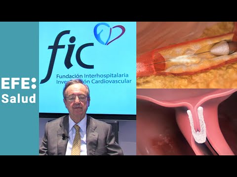 Noticias del Corazón: "Innovación cardiovascular que salva vidas"