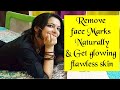 How To Remove Face Marks Naturally DIY Yoga Ayurveda Home Remedies