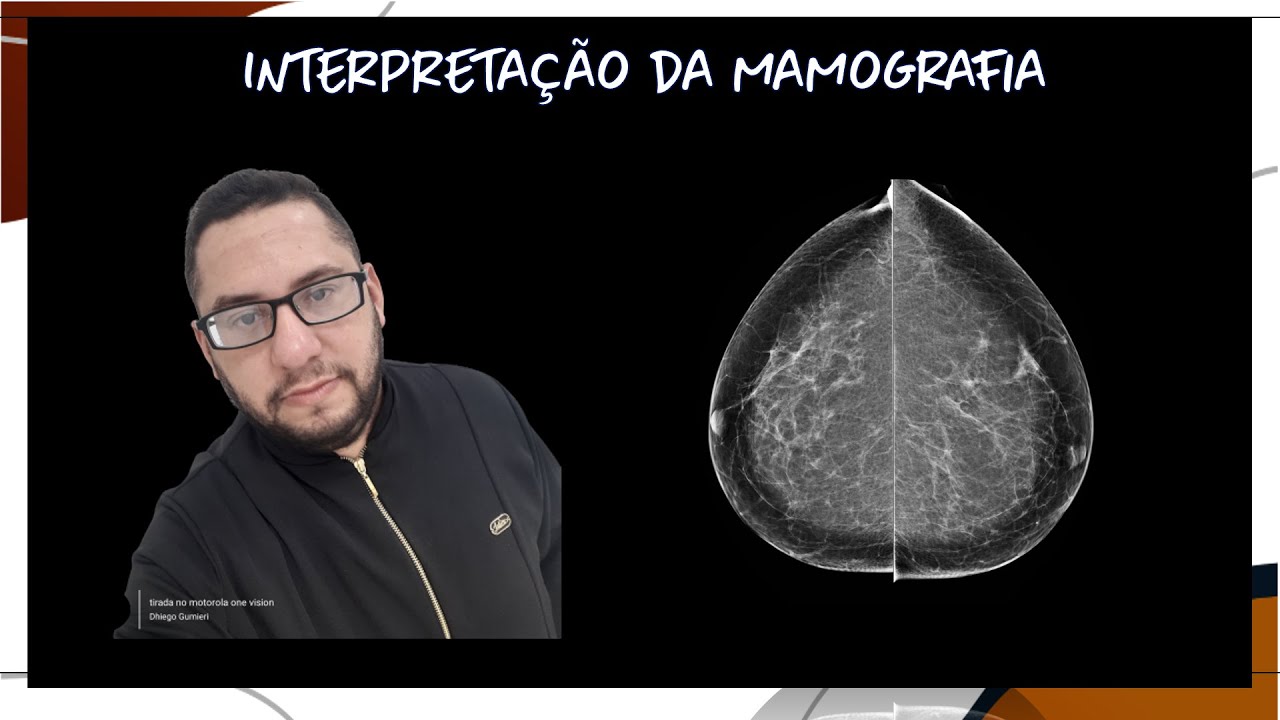 Noções básicas de Mamografia