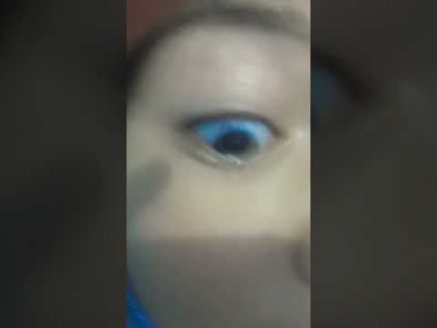 se mekito un ojo.😱😱👁️