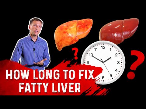 4 Critical Tips to Reverse a Fatty Liver – Dr Berg