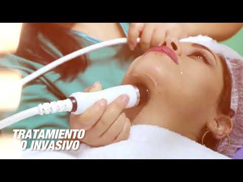 Radiofrecuencia Facial