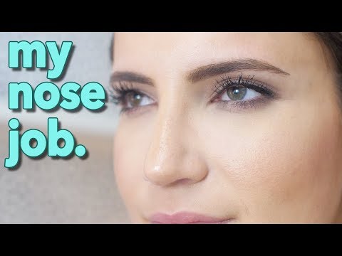 NOSE JOB BEFORE & AFTER | My Beverly Hills Rhinoplasty Experience