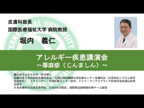 国際医療福祉大学熱海病院　オンライン健康講座「アレルギー疾患講演会―蕁麻疹（じんましん）」堀内 義仁　病院教授