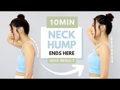 NECK HUMP (Forward Head) Ends Here! — 10min Daily Posture Correction Workout