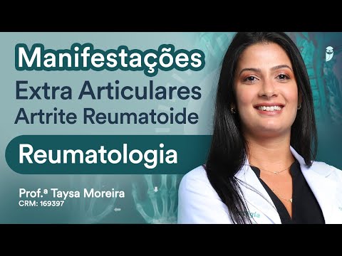 Extra-Articular Manifestations in Rheumatoid Arthritis - May Class Medical Residency
