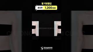 이게 같은 팔이라고요?