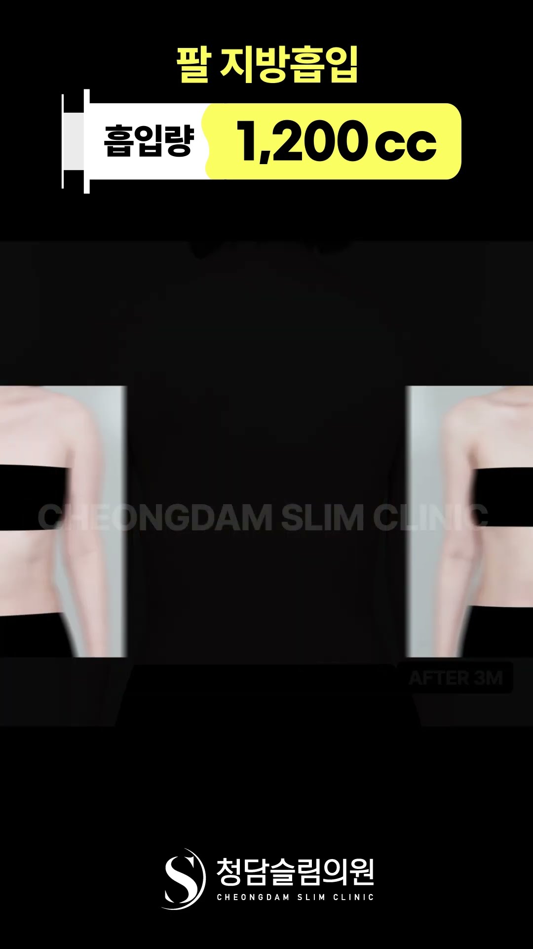 이게 같은 팔이라고요?