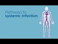 Pathways to Systemic Infection Animation