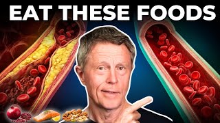 Top 5 Foods to Clean Your Arteries (Backed by Science)