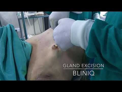 Patient Recovery Case — Video 20 (Clinical Testimonial)