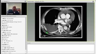 Step2 2CK  IM: Pulmonary Medicine
