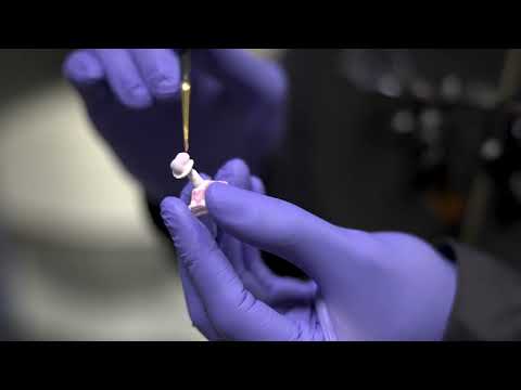 CEREC Crowns with Dr. Al Fadhli