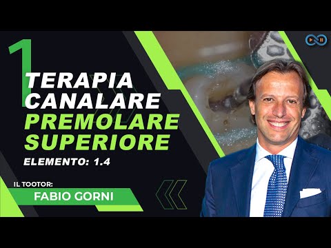 Terapia scanalare premolare superiore elemento 1.4