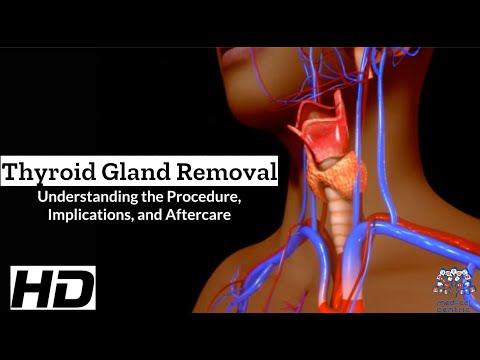 Thyroid Surgery Explained: What They Don't Always Tell You