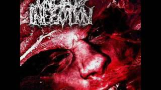 Dead Infection - It&#39;s Over