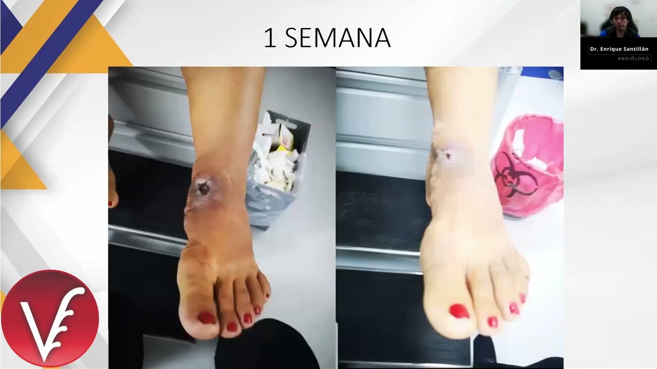 Enrique Santillán Aguayo-25