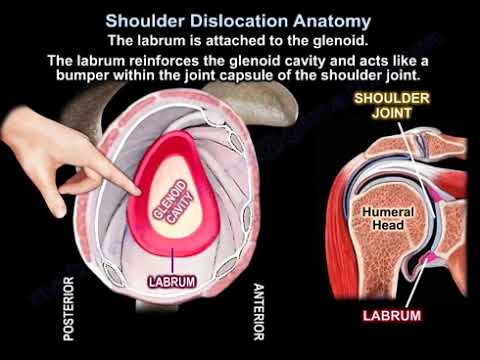 Shoulder Dislocation Explained – Anatomy, Causes, Lesions, and Treatment