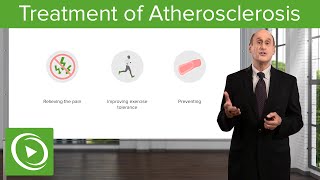 Treatment of Atherosclerosis: Therapy Goals & Lifestyle Measures – Vascular Medicine | Lecturio