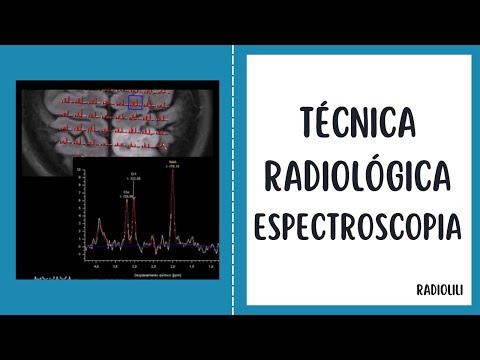 Magnetic Resonance Spectroscopy: Radiological Technique.