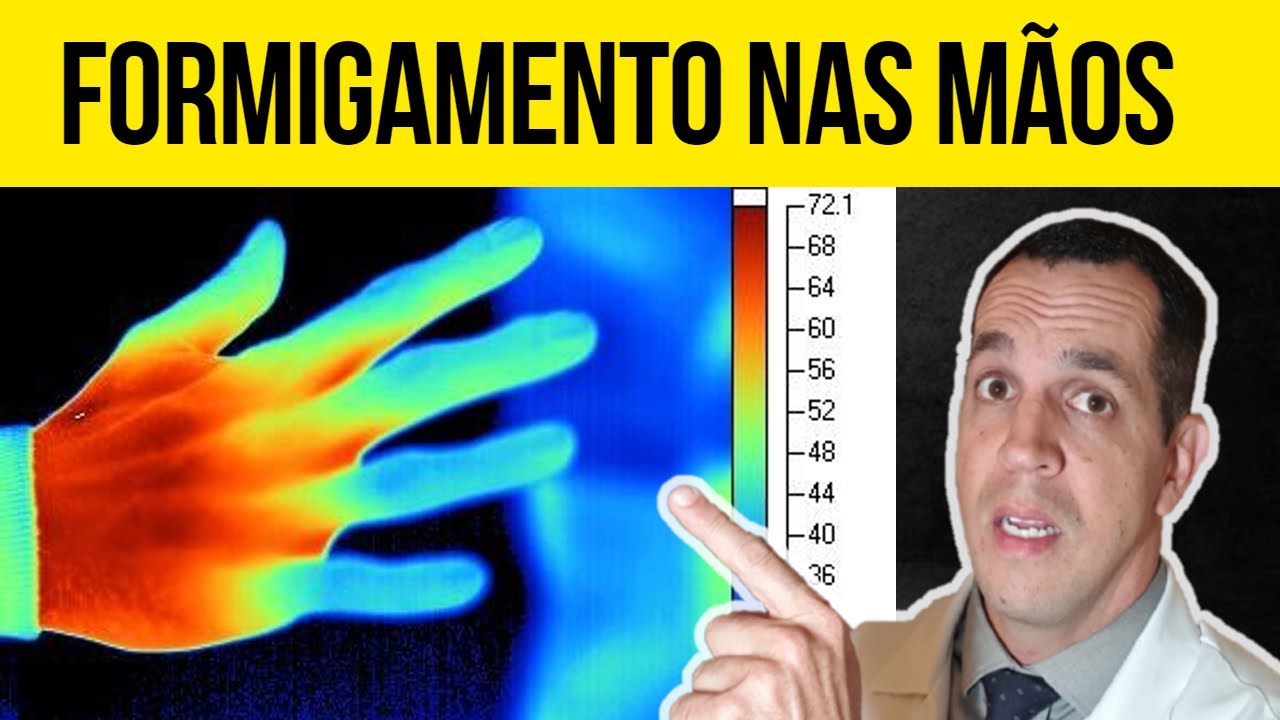 FORMIGAMENTO NAS MÃOS - 8 CAUSAS DE DORMÊNCIA NAS MÃOS QUE VOCÊ DEVE SABER