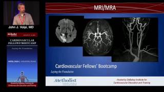 Download Lagu Diagnosis and Medical Management of Stroke (John J. Volpi, MD) Saturday,, August 20, 2016 Thumbnail