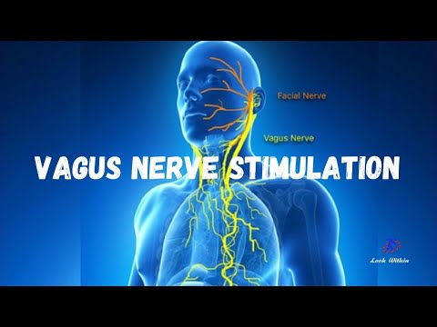 Vagus Nerve Stimulation Via Matured Bitter Hops Extract