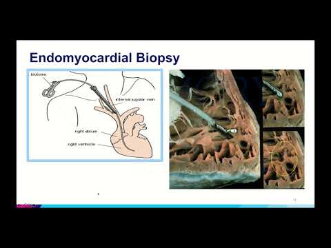 Emory Cardiology Grand Rounds 1-28-2019
