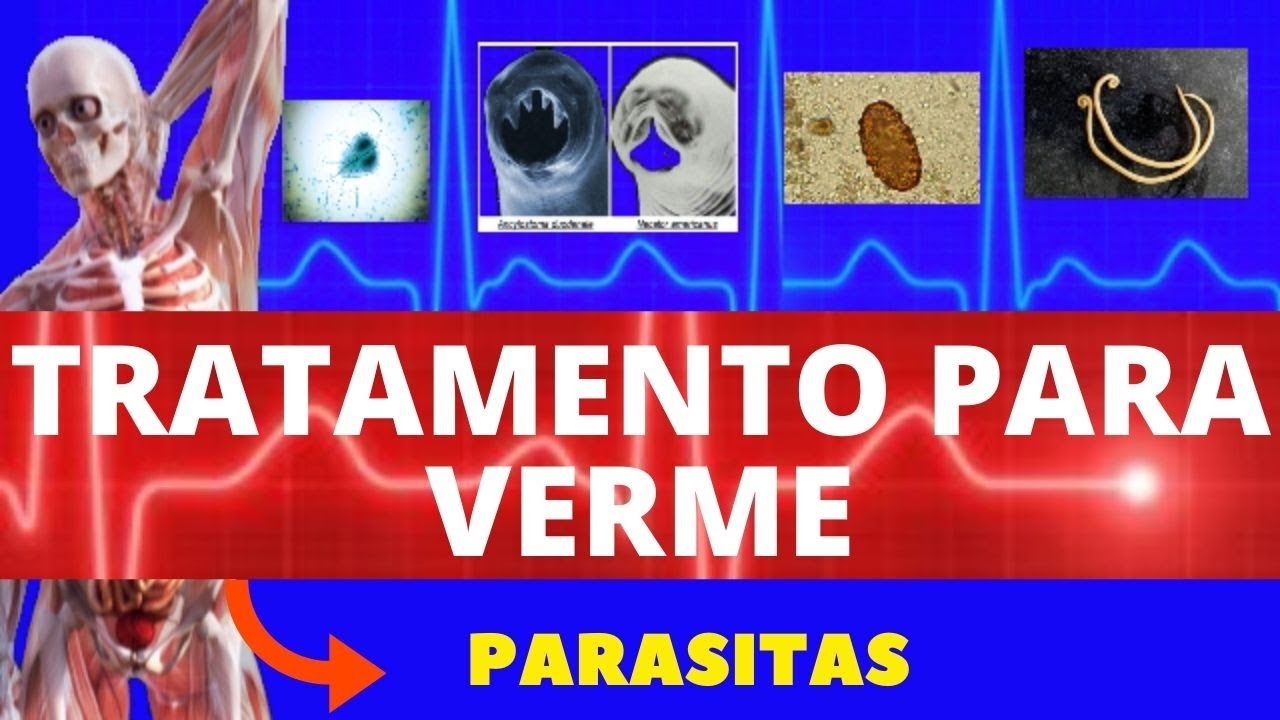 TRATAMENTO PARA VERME (REMÉDIO PARA VERMES) - COMO ACABAR COM OS VERMES - PARASITOLOGIA