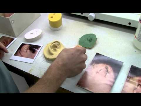 Prosthetic ears: how they're made