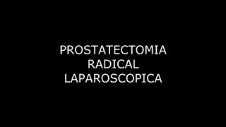 Prostatectomia Radical Laparoscopica - Francisco Javier Machuca Santa Cruz