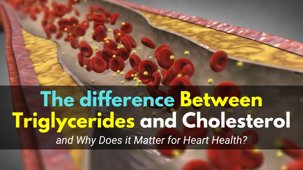 The difference Between Triglycerides and Cholesterol and Why Does it Matter for Heart Health?