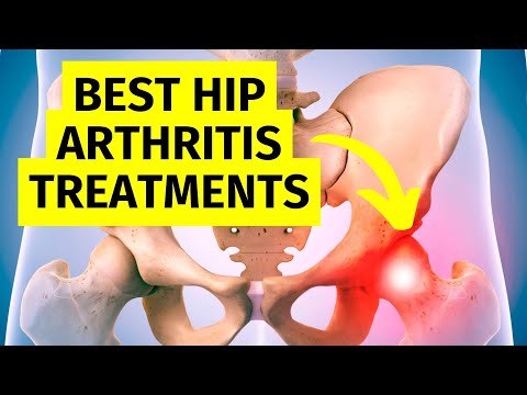 My BEST Hip Arthritis Treatments Without Surgery