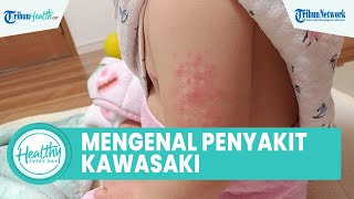 Mengenal Penyakit Kawasaki yang Kerap Menyerang Balita agar Mencegah Kerusakan Arteri