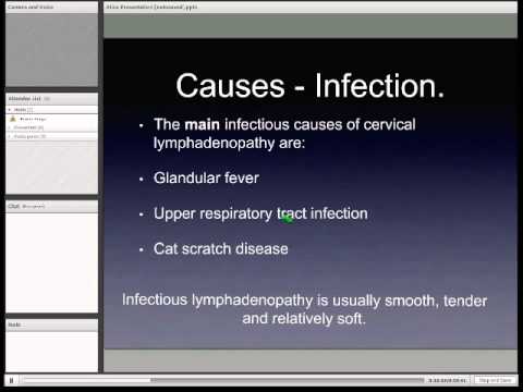 Cervical Lymphadenopathy - YouTube