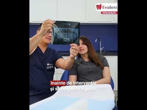 Sunt sigure implanturile dentare?