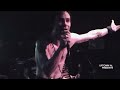 L E S Stitches Never Coming Back Live 2006