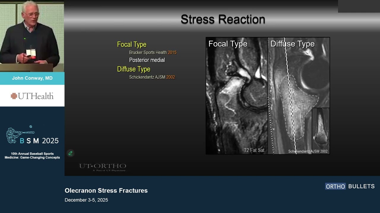 Olecranon Stress Fractures_John Conway MD
