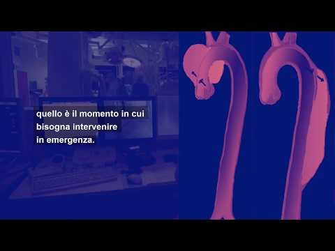 Curarsi a ISMETT: i programmi di cardiochirurgia