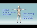What are the treatments for rheumatoid arthritis?