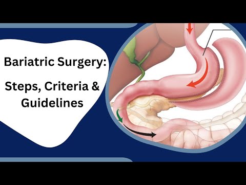 Bariatric Surgery Explained: Step-by-Step Guide to a Successful Weight Loss Journey!