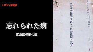 【生配信】北陸の奇病と学校給食の関係について　[富山県骨軟化症についての解説]