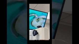 MB1, MB2, DB1, DB2, P. #dentists #dentalprosthesis #dentalcare #rootcanaltherapy #dentalartistry