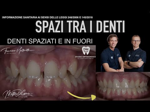 Francesco Martinetti-20