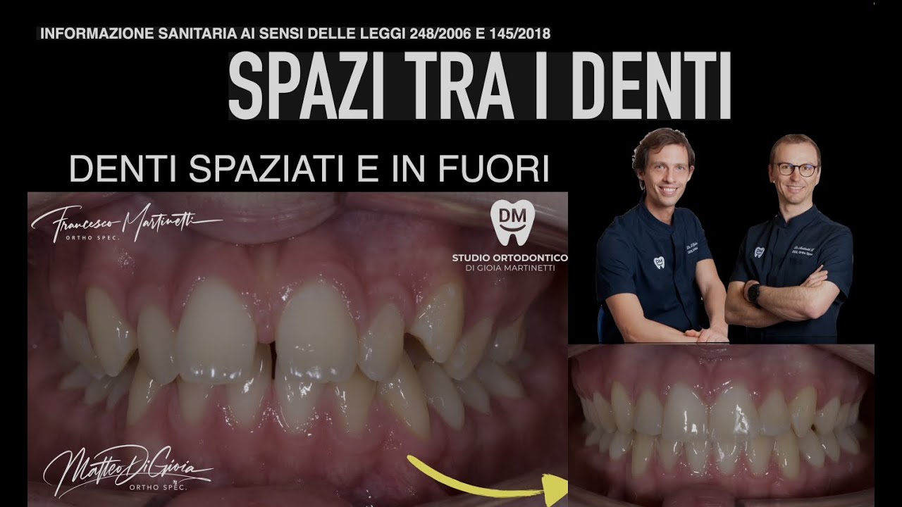 Francesco Martinetti-20